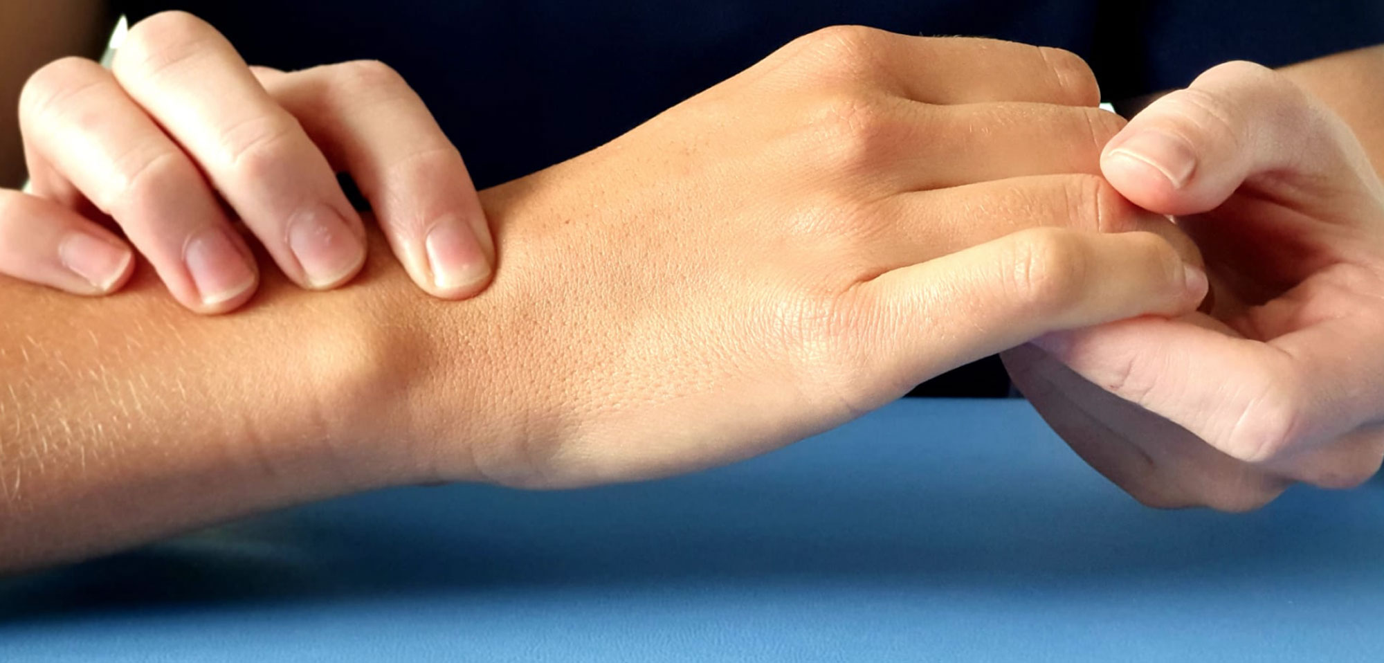 Kyste synovial, pathologie fréquente de la main
