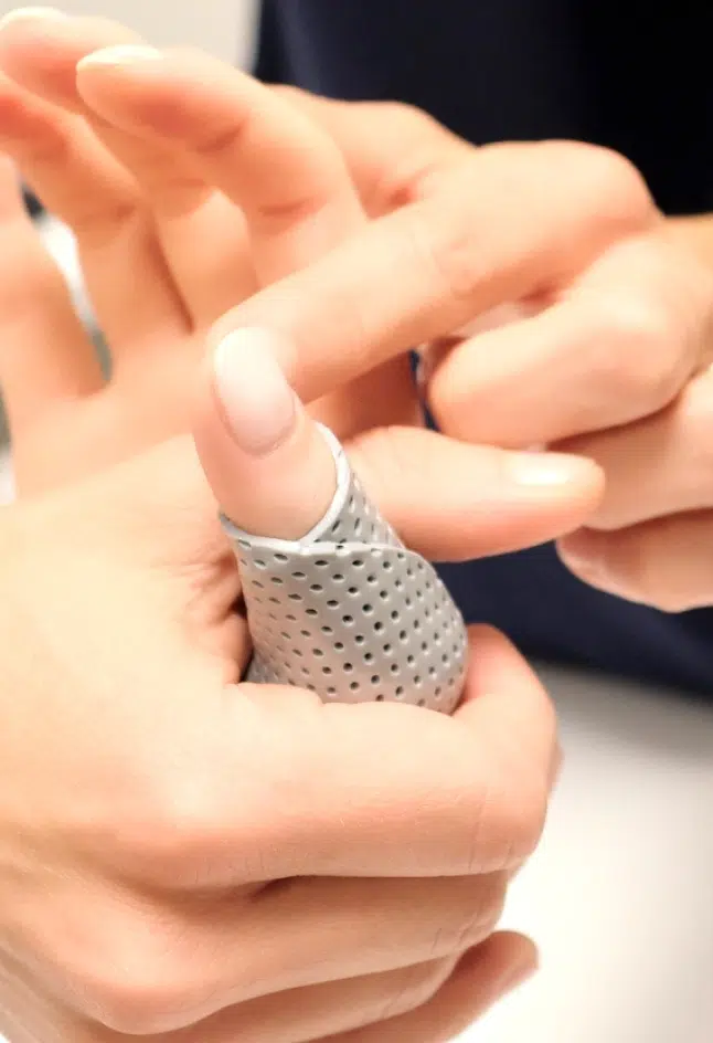 Photo rapprochée de deux main une tenant l'autre - attelle sur mesure | Leman hand Clinic Genève